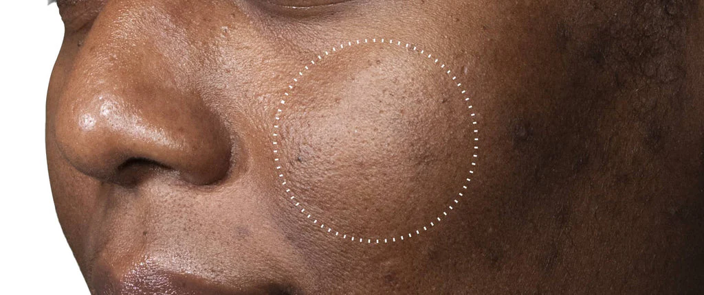 La science d'une peau radieuse